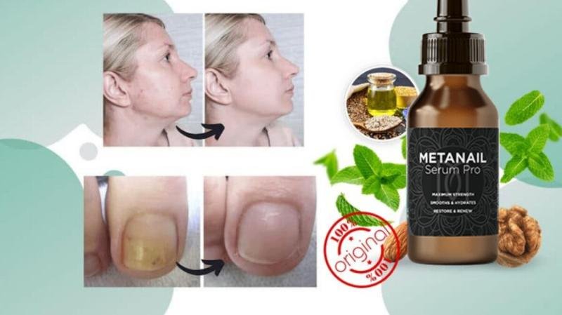 MetanailComplex.com Supplement